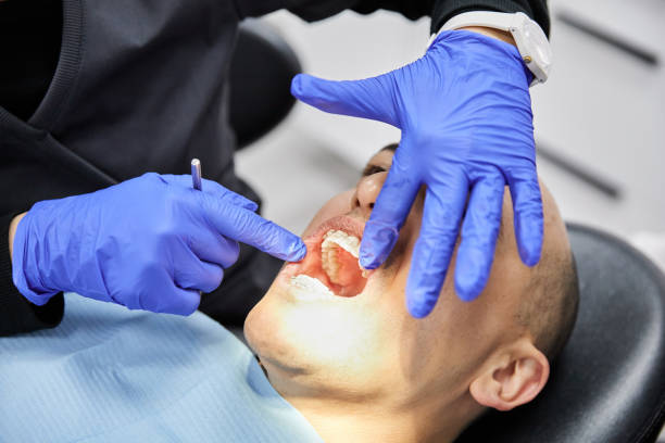 Best Emergency Treatment for Dental Infections or Abscesses in Crestview, FL